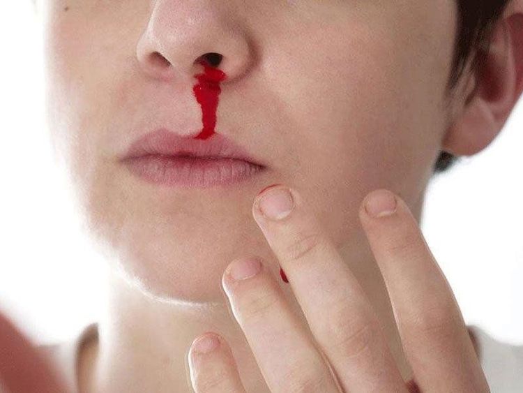 Nằm Mơ Thấy Chảy Máu Đánh Số Mấy Đổi Vận Cấp Tốc?